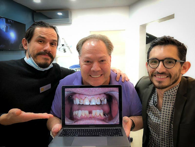 Dr. Nestor and Dr. Diego, dentist in Los Algodones at SOTA Dental, look at the camera with an older male patient. The patient is holding a laptop computer displaying his teeth before his all-on-4 surgery. Everyone is smiling.