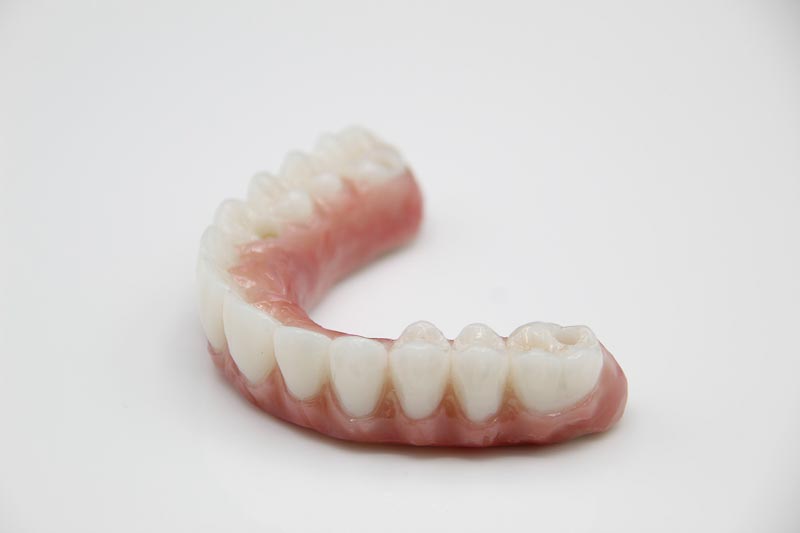 Side angle of an all-on-4 denture in Mexico.