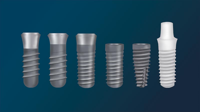 Six different types of dental implants with different shapes and sizes.