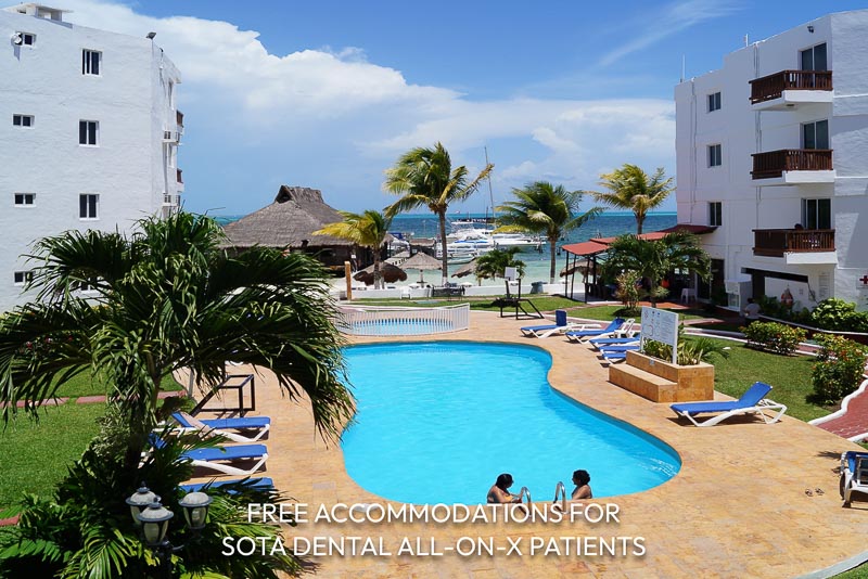 Free accommodations for SOTA Dental All-on-4 patients in Cancun, Mexico.