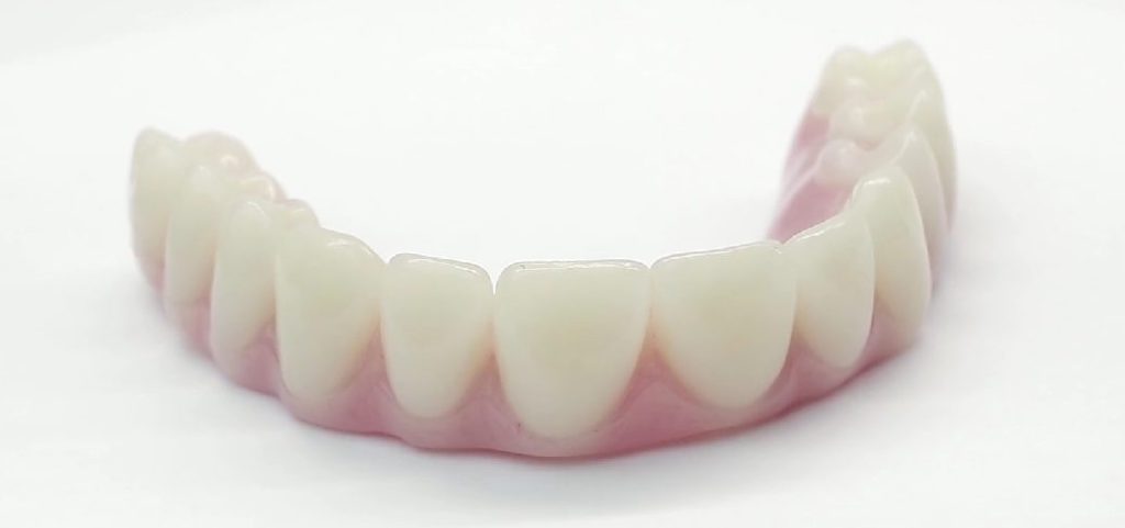 Permanent Bottom Denture