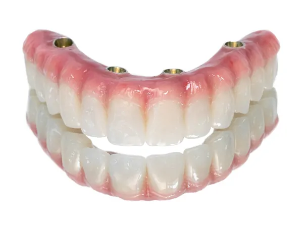 An All on 4 denture.