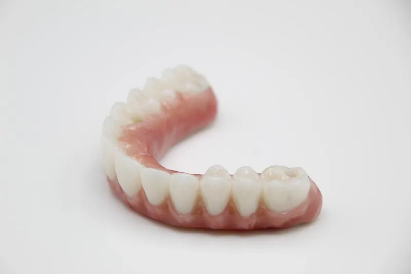 Side angle of an all-on-4 denture in Mexico.