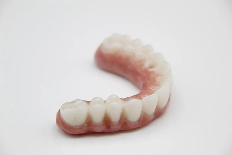 Side angle of an all-on-4 denture in Mexico.