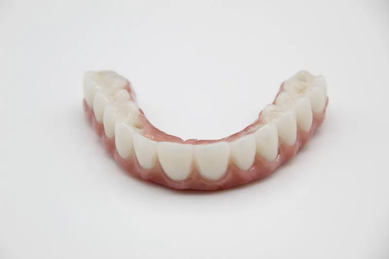 Front angle of an all-on-4 denture in Mexico.